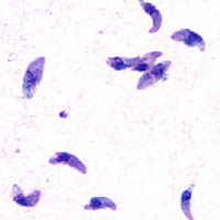 Zdjęcie mikroskopowe toxoplasmy